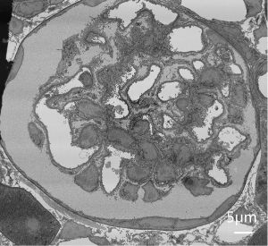 sem image analysis Glomerulus